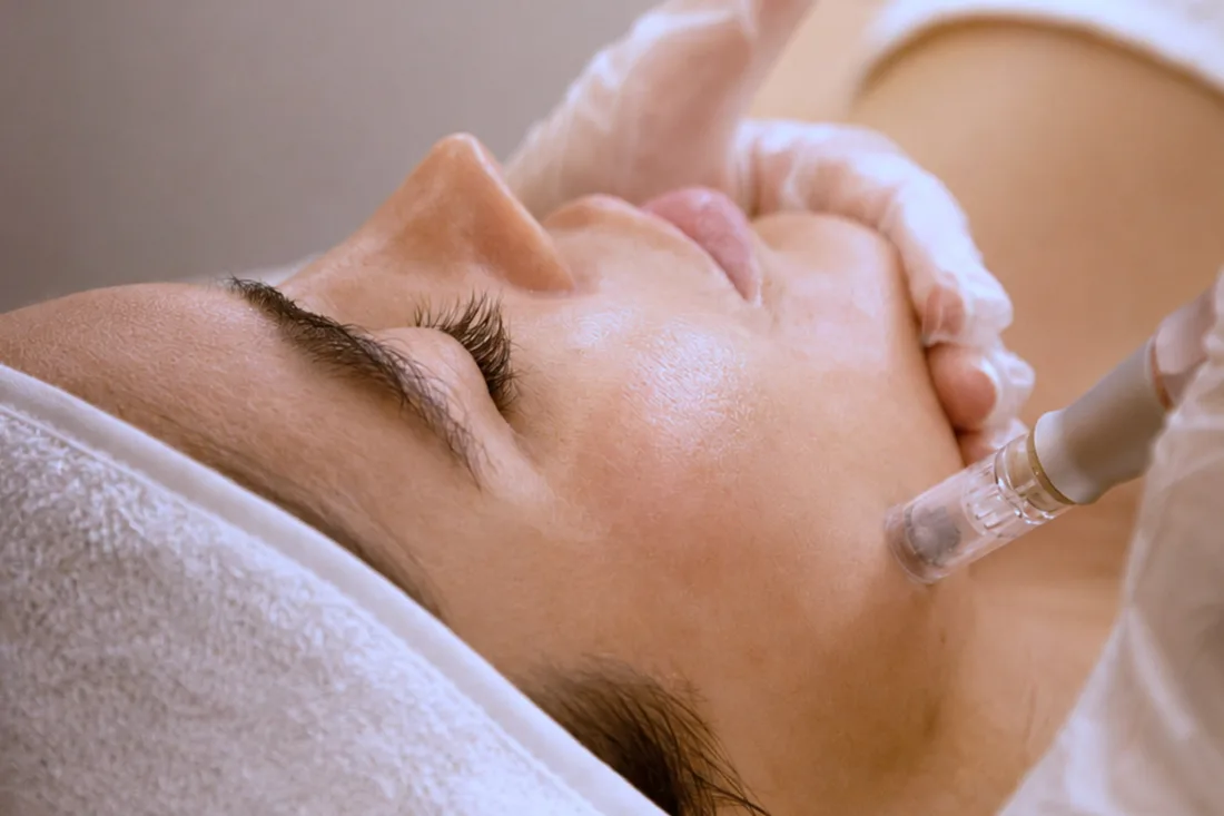 Cabezal de aparatología facial sobre la mejilla